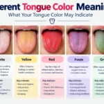different tongue color meanings